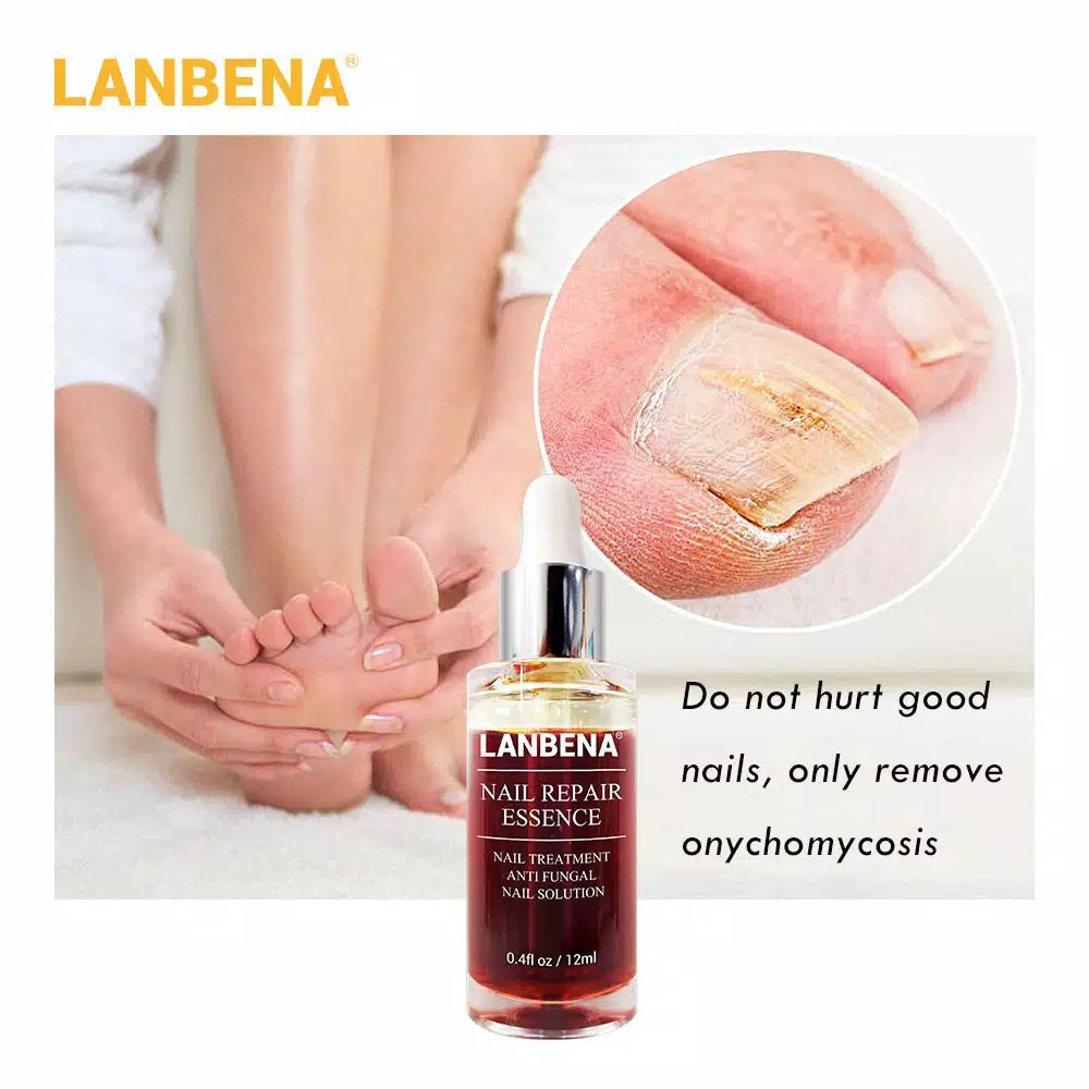 Lanbena Nail Repair Essence Oil Serum Nail Treatment