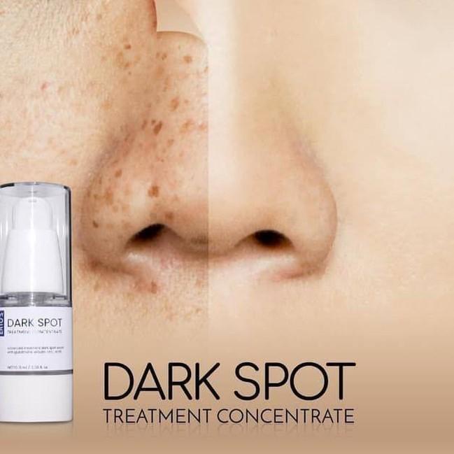 Penghilang Flek Hitam Membandel Ertos Dark Spot Serum