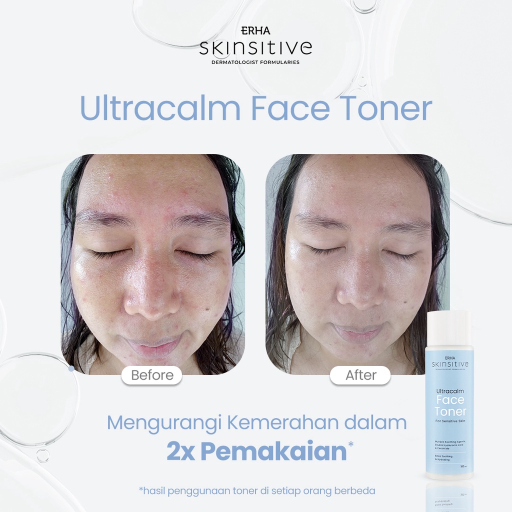 ERHA Skinsitive Skin Barrier Moisturizer / UltraCalm Toner / Face Wash / Body Lotion / Sensitive