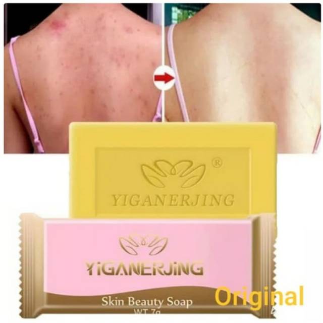 Ready Yiganerjing Sulfur Sabun Gatal Natural Kontrol Anti Bakteri