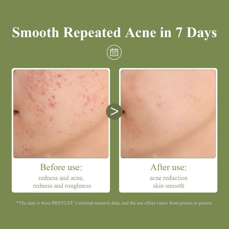 BREYLEE CLEARING PAD/BREYLEE EXFOLIATING