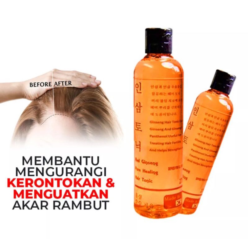 Red Ginseng Hair Tonic Original - Penumbuh dan Melebatkan Rambut &amp; Mencegah Rontok