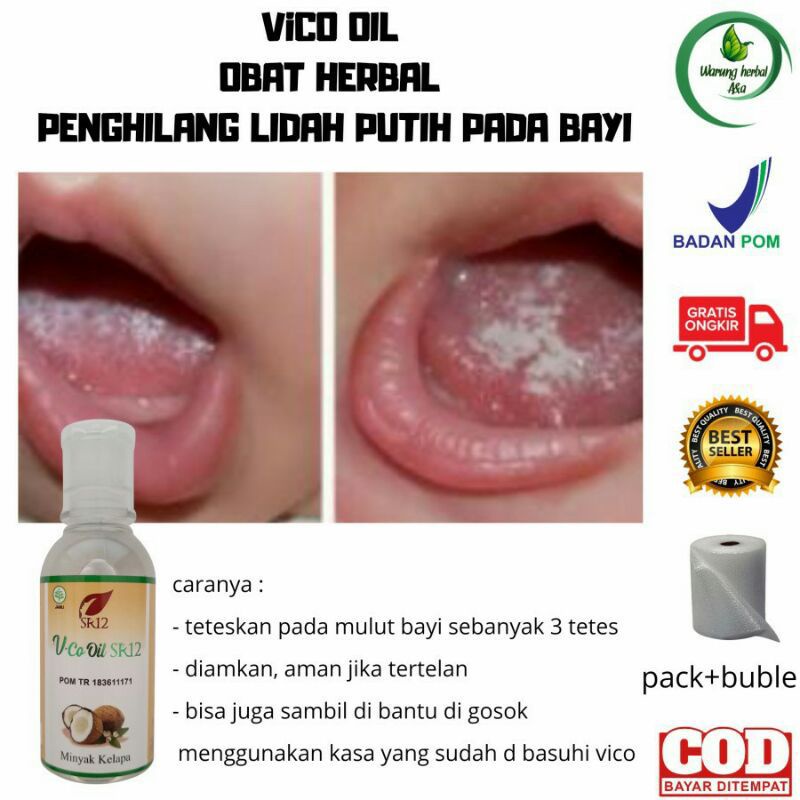 SR12 AMPUHHH OBAT LIDAH PUTIH PADA BAYI/OBAT JAMUR LIDAH AMAN BAYI & BALITA/VCO SR12 SARIAWAN LIDAH 