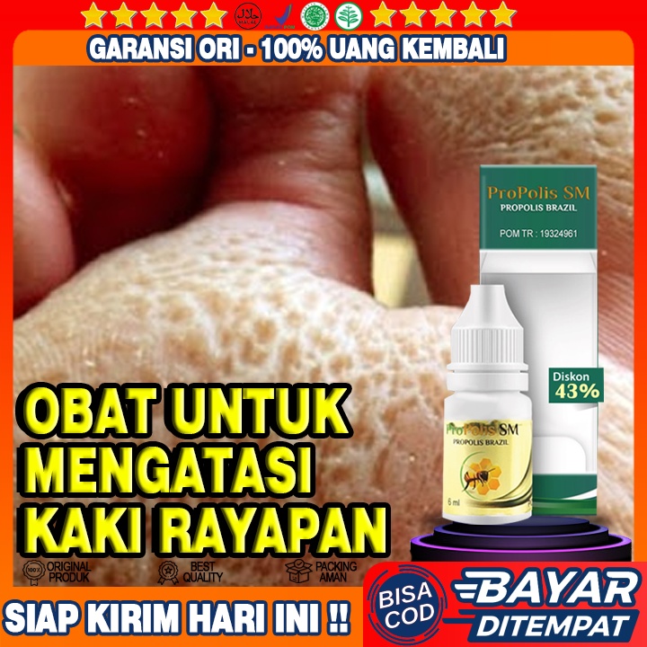 Obat Penghilang Kaki Rayapan, Obat Kaki Bolong Bolong, Obat Kaki Bolong, Obat Telapak Kaki Bolong