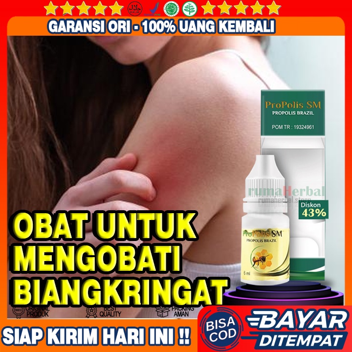 Obat Biang Keringat, Obat Biang Keringat Di Wajah, Obat Biang Keringat Gatal, Obat Gatal Gatal, Obat