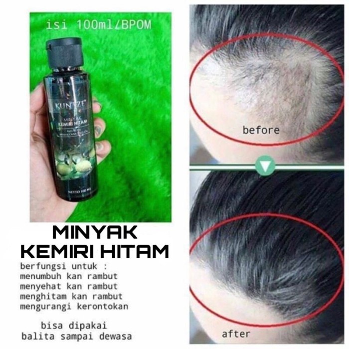 COD ROEGAN Minoxidil 5% - Penumbuh Rambut Brewok (untuk Botak & Rontok) -