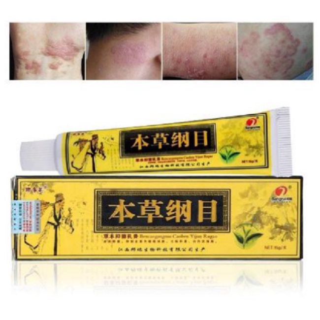 Salep Gatal Gatal Salep Kuning Ampuh Mengobati Gatal Salep Kulit Gatal Kudis Jamur