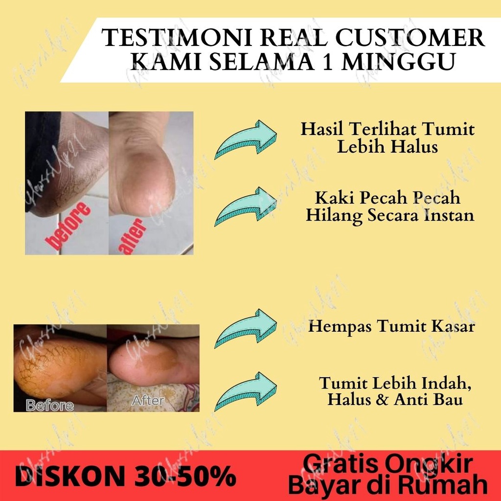 TUMITKU OBAT KAKI PECAH TUMITKU 60ML OBAT HERBAL MENGATASI KAKI PECAH PECAH 60ML ORIGINAL BPOM