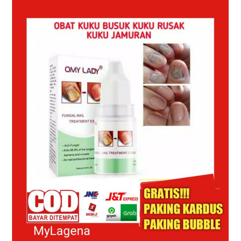 OBAT JAMUR KUKU  CANTENGAN KUKU RUSAK