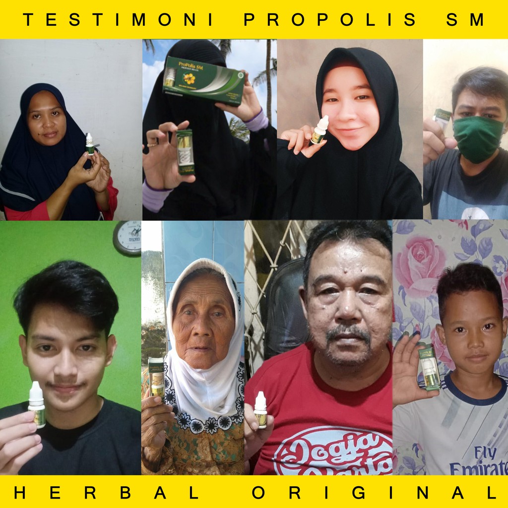 Obat Eksim Kering Basah Kering  Gatal Gatal Jamur Kulit Kepala Salep Eksim Scabies Obat Gatal Kudis Kurap Kutu Air Obat Gatel Selangkangan Berjamur Aman Balita Propolis SM Brazil Original 100% Asli-8