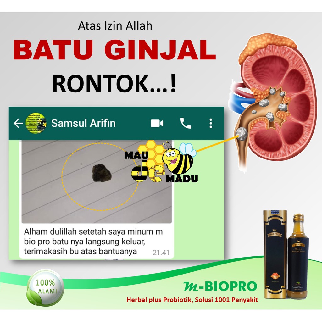 Mbiopro M Biopro M Bio Pro Original Herbal Asli Obat Batu Infeksi Gagal Ginjal Kronis Herbal