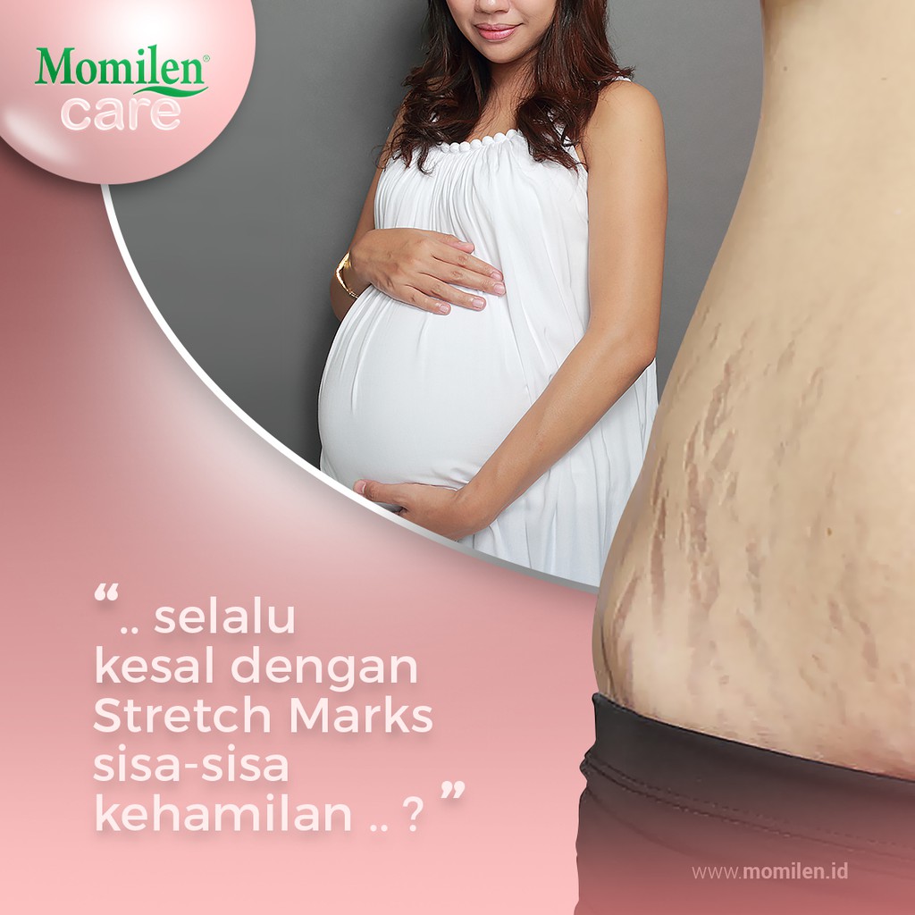 MOMILEN Stretch Mark Cream 30gr / Intensive Tummy / Penghilang Selulit / Garis Perut / Luka Perut