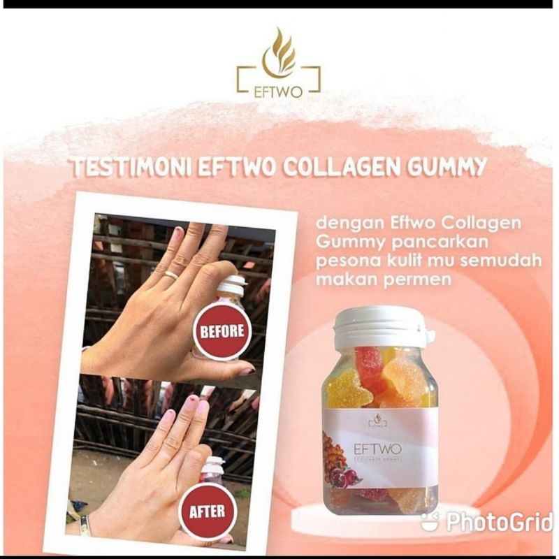 EFTWO COLLAGEN GUMMY