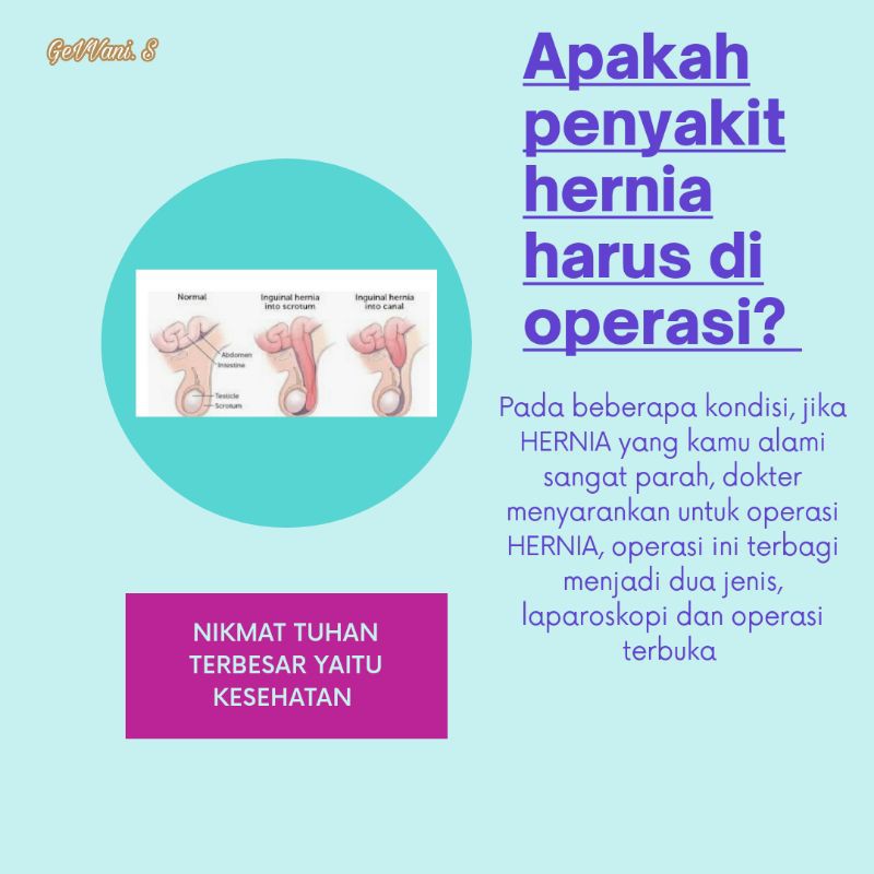 Celana Hernia Dewasa Celana Terapi Hernia Original Murah Berkualitas