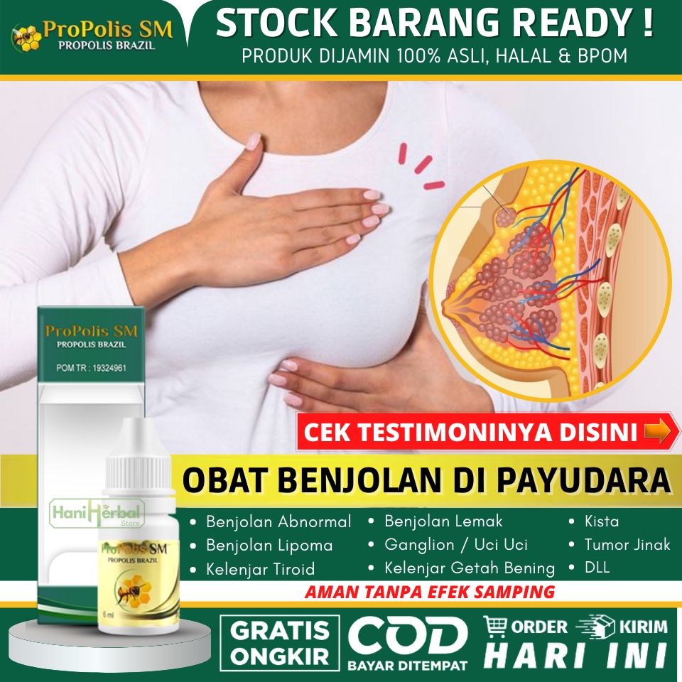 Obat Alami Penghilang Benjolan Di Payudara Ibu Menyusui, Penghancur Kista Payu Dara, Pengecil Fibroa