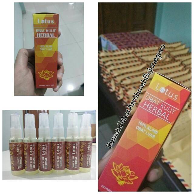 

Lotus obat kulit herbal