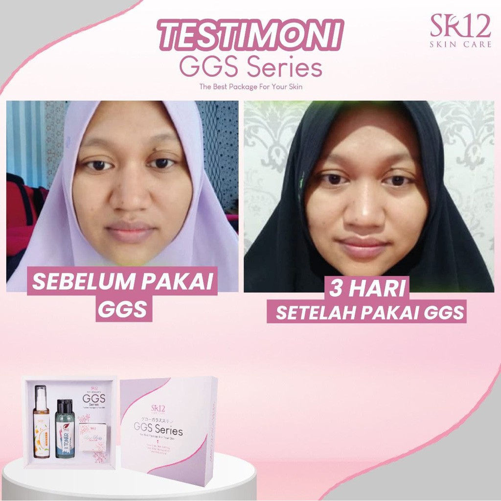 GGS SERIES SR12 GLOW GLASS SKIN GEL PAKET GLOWING BPOM MENCERAHKAN MENGHILANGKAN FLEK HITAM