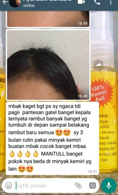 Minyak Kemiri Original Penumbuh Rambut Brewok Minyak Kemiri Asli Shopee Indonesia