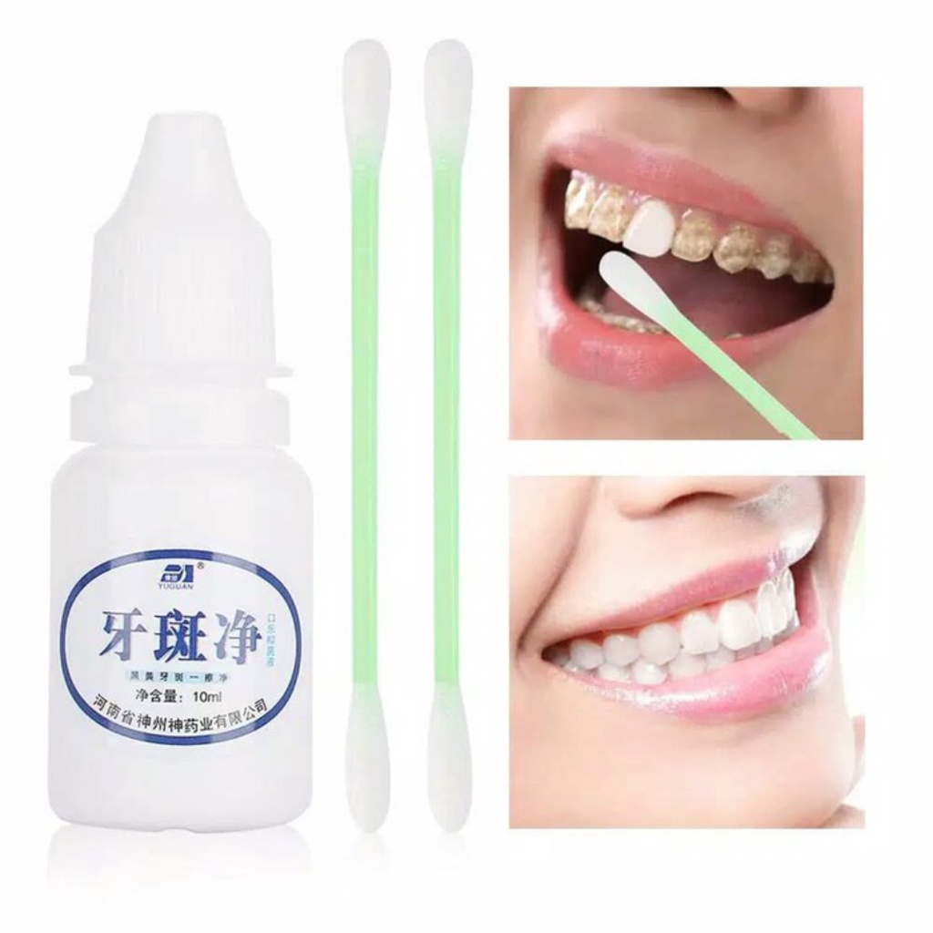 SHINE STAR - COD - Teeth Whitening Essence - Pemutih Gigi Kuning Instan Permanen &amp; Perontok Karang Gigi