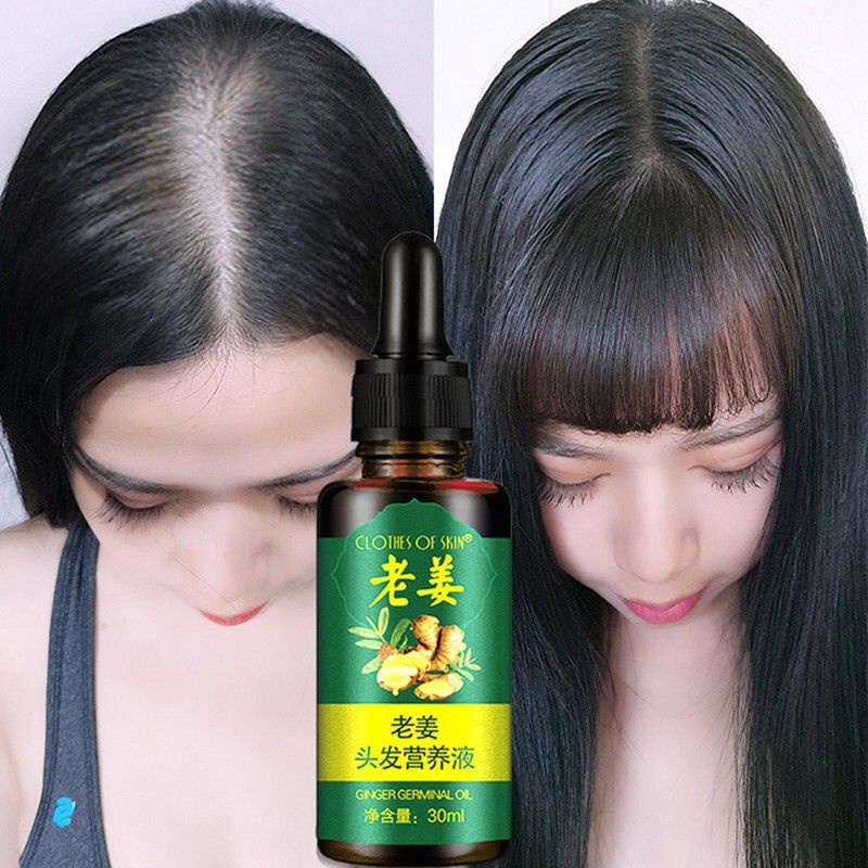 Serum Anti Rontok Zhi Ran Mei Cairan Essence Penumbuh Rambut Clothes of Skin 7 Days Ginger Germinal Oil 30ml