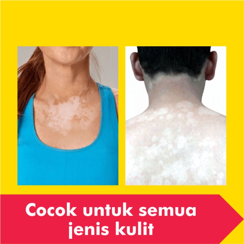 Obat Salep Panu Paling Ampuh Gatal Kulit Kurap Kutu Air Jamur Selangkangan Gatel Eksim Jerawat Kudis-5