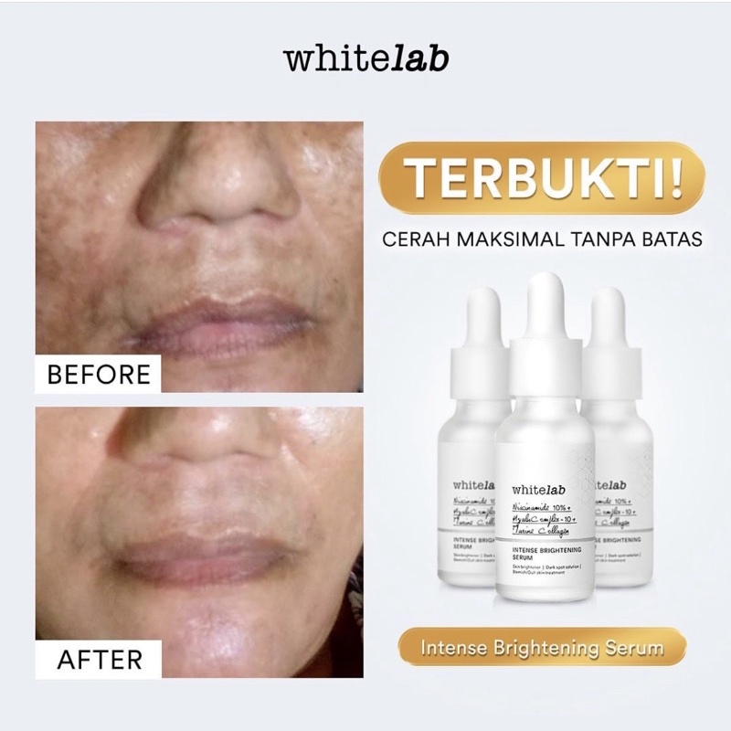 WHITELAB Brightening Paket Wajah Serum + Night Cream + Day Cream + Facewash + Toner