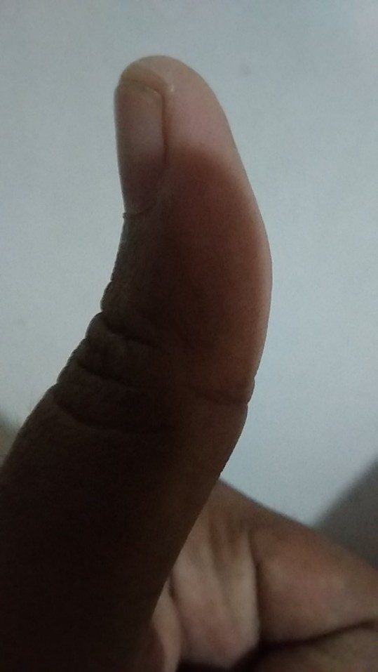 Kotak Obat|kotak P3k Display Dinding