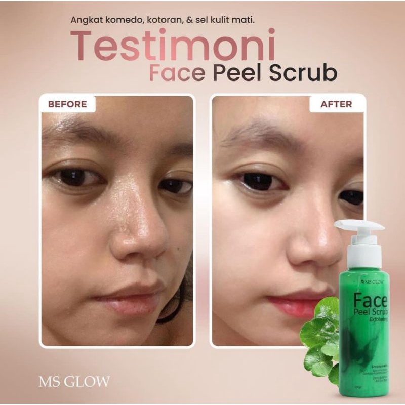 Face Peel Scrub Ms Glow