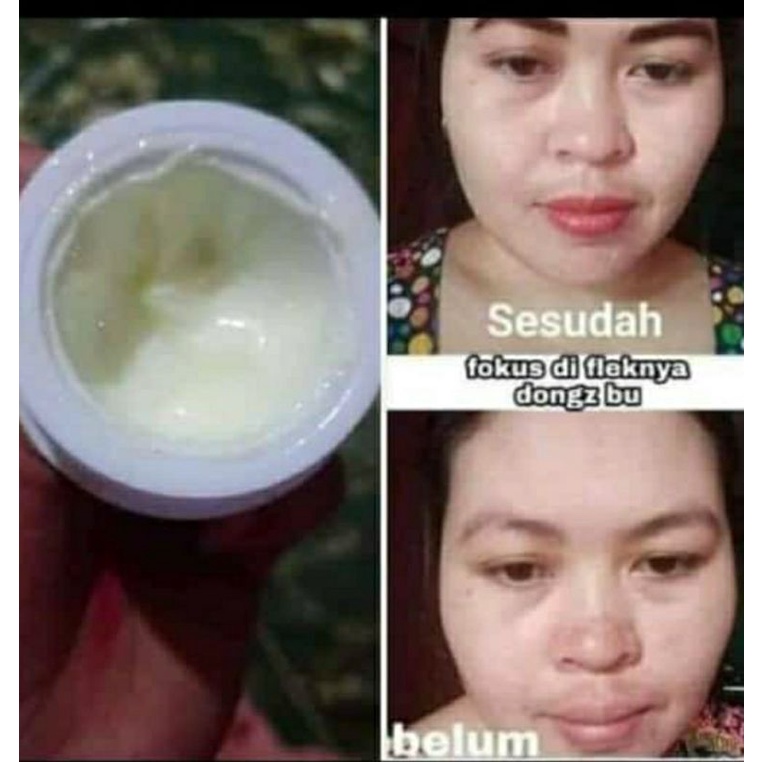 Creammalam/night cream Rk klinik