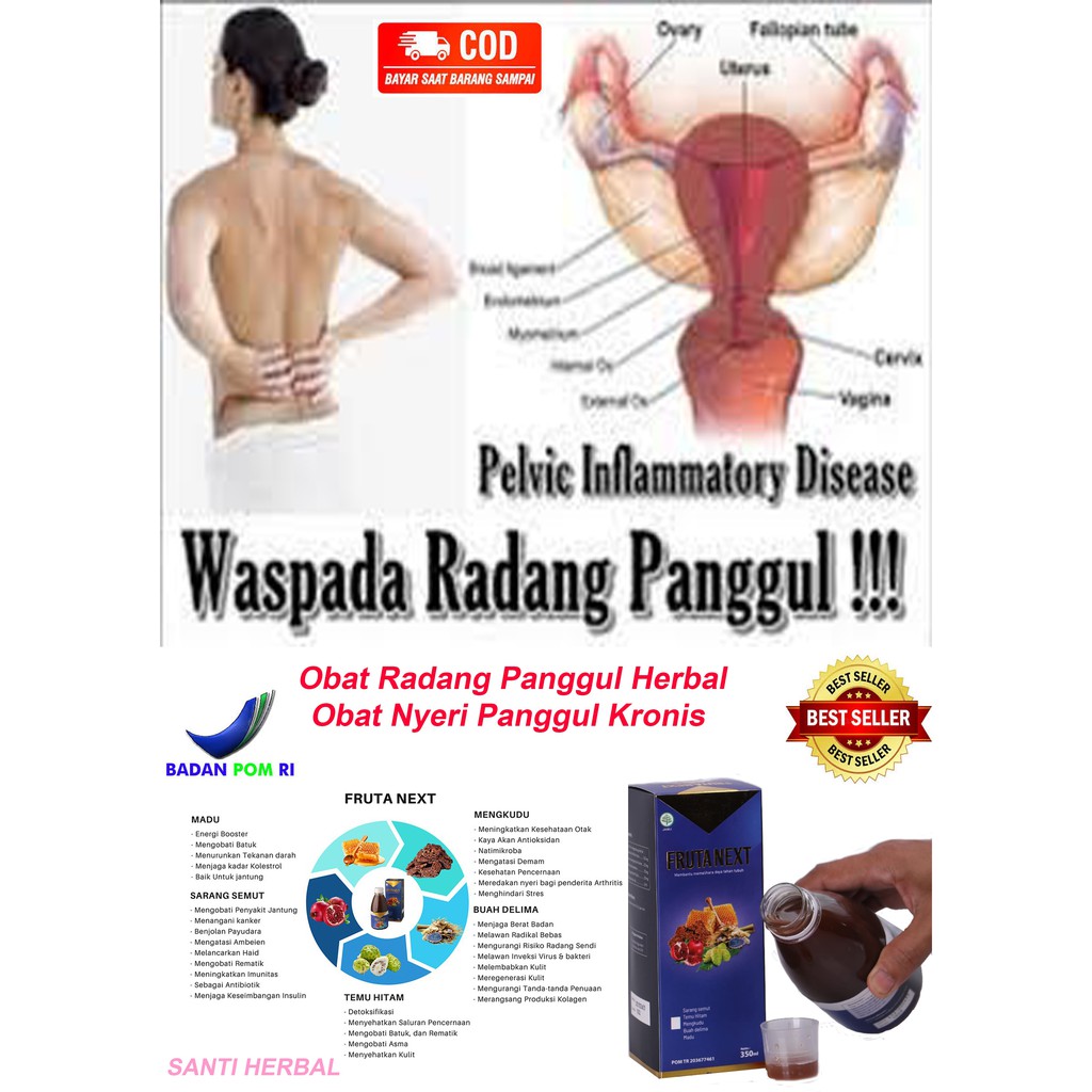 Obat Radang Panggul Herbal Obat Nyeri Panggul Kronis FRUTANEXT