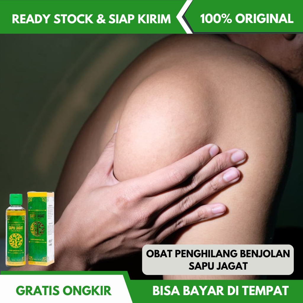 Jual Obat Oles Benjolan Lipoma Benjolan Di Leher Tangan Punggung Ketiak Gondok Gondongan