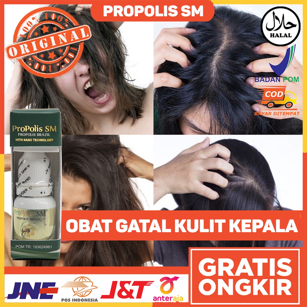Obat Gatal Kulit Kepala - Obat Psoriasis Kulit Kepala - Obat Kulit Kepala Gatal Parah - Obat Jamur K