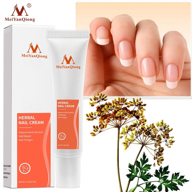 MeiYanQiong Herbal Nail Treatment Onychomycosis Paronychia Anti Fungal