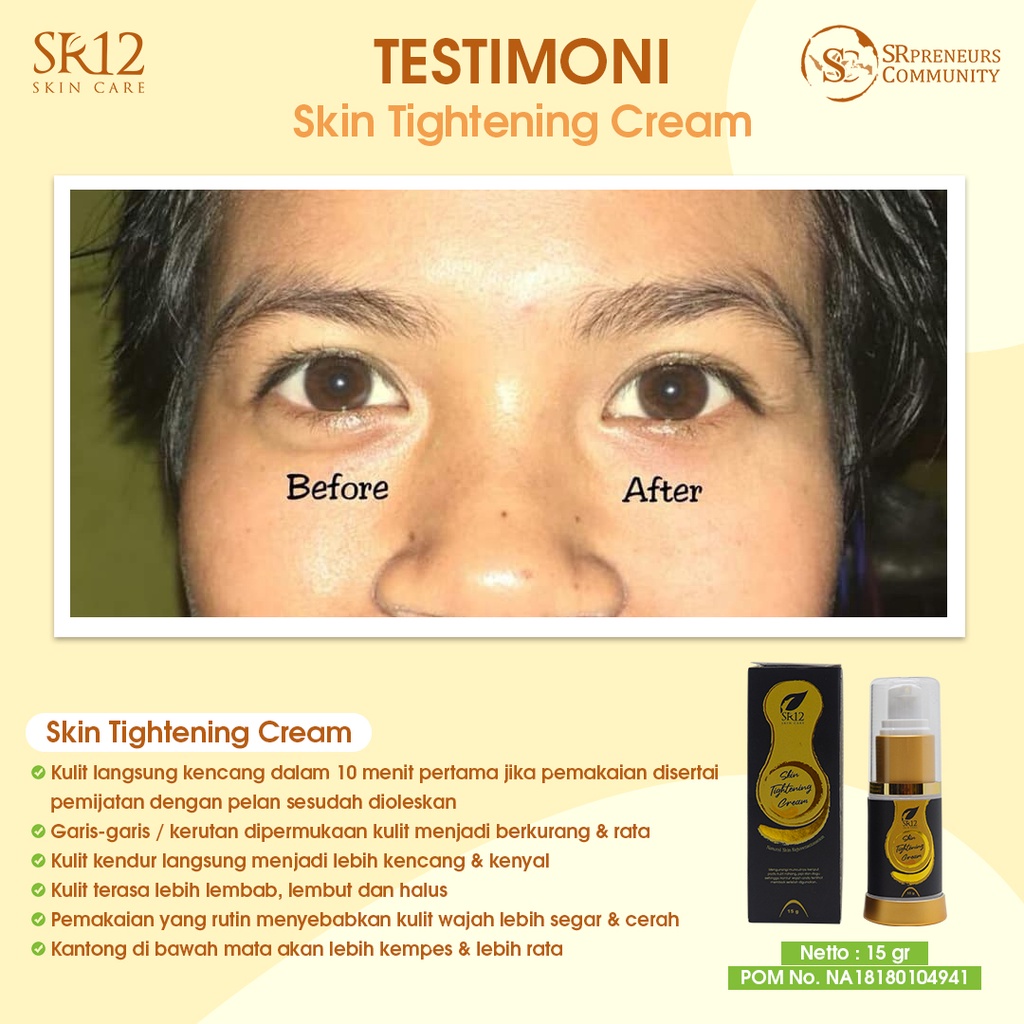 SR12 HERBAL SKINCARE TIGHTENING CREAM WHITENING TERBAIK PENCERAH WAJAH / PENGENCANG ANTI KERUT WAJAH