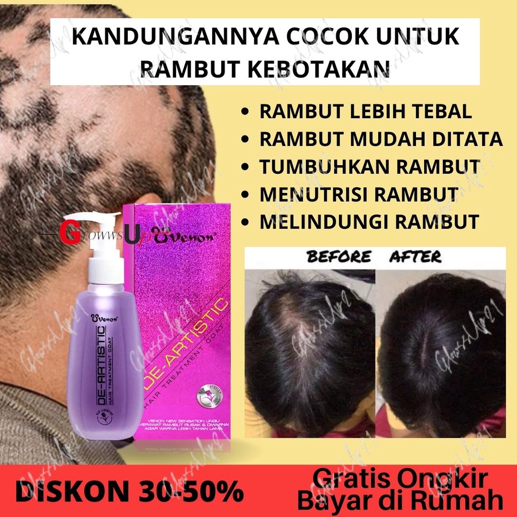 SERUM PENUMBUH RAMBUT BOTAK VENON UNGU SERUM RAMBUT PERAWATAN RAMBUT - HAIR TREATMENT