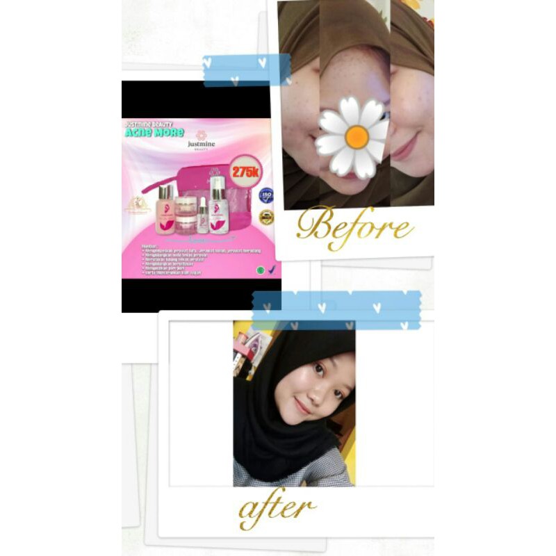 

justminebeautyskincareBPOMHALAL
