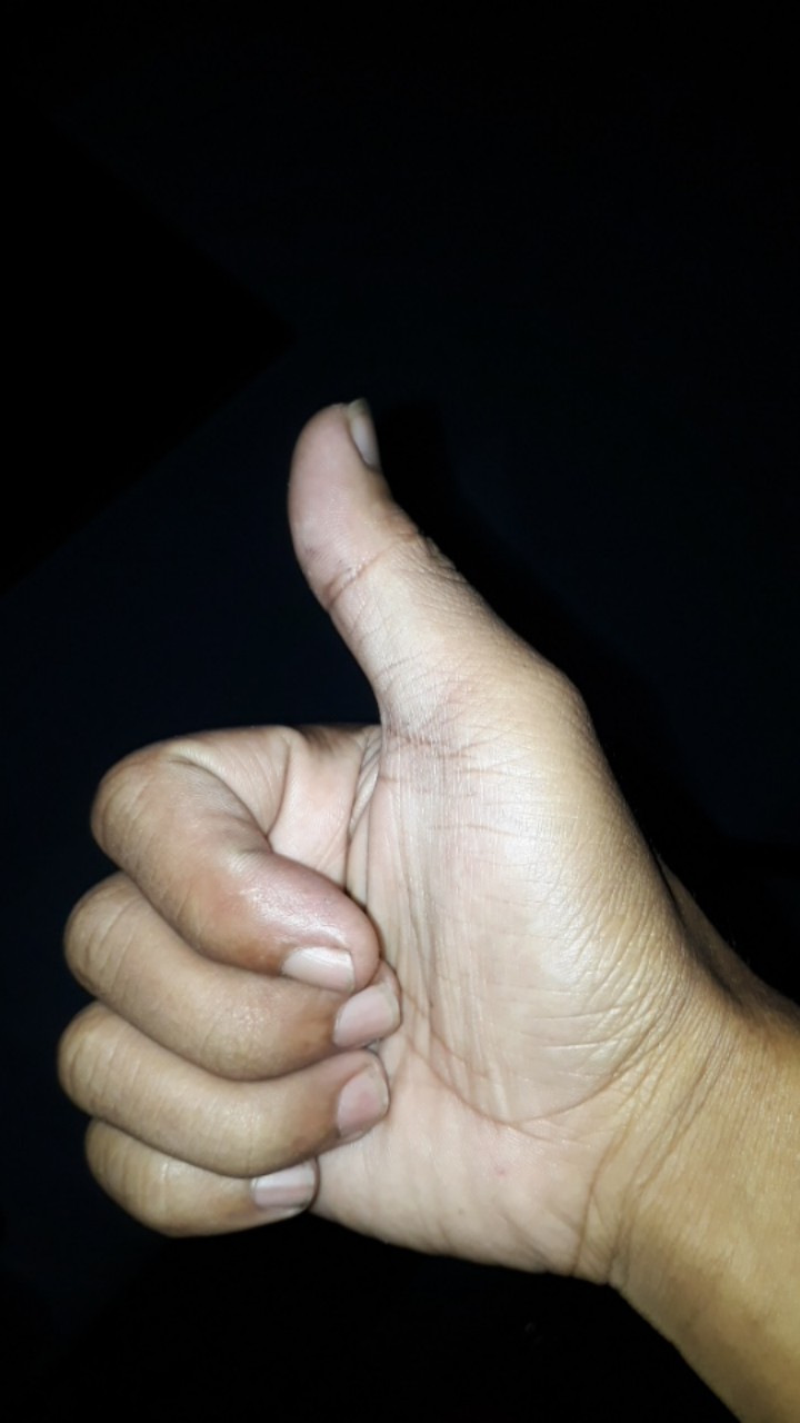 [lem Lalat] Obat Lalat- Racun Lalat Zhang Pei Zhen Ori 100%