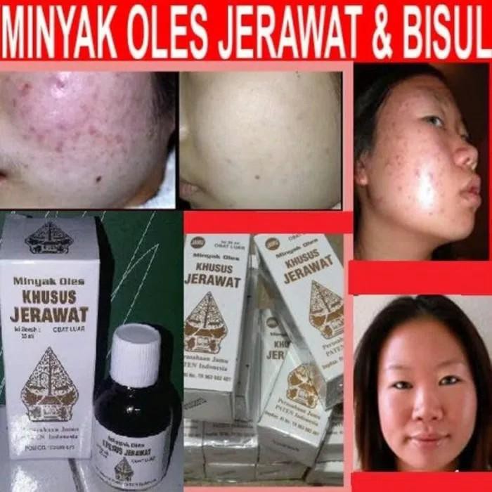 MINYAK OLES JERAWAT CAP WAYANG / SERUM JERAWAT WAYANG 35ML