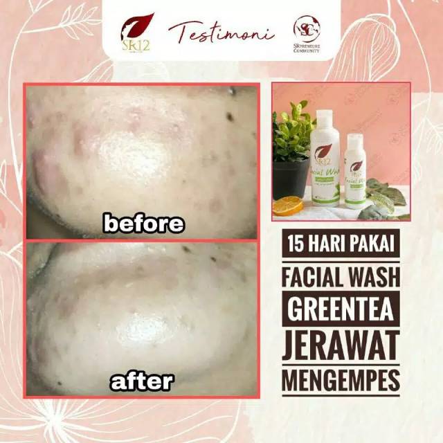 SABUN WAJAH GREENTEA SR12 / FACIAL WASH KULIT NORMAL / BERMINYAK / BERJERAWAT