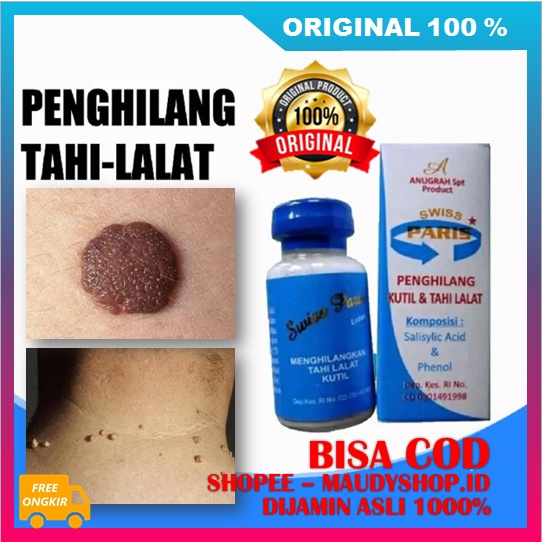 Salep Kutilat Swissparis Penghilang Kutil Dan Tahi Lalat Ampuh BPOM ASLI ORI