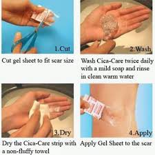 Cica care Silicon Gel Sheet Dressing luka untuk mencegah dan mengatasi keloid ukuran 12 x 15 cm