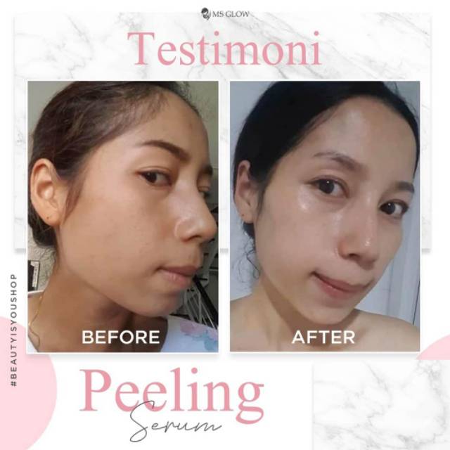 Msglow Serum Peeling - 1 item