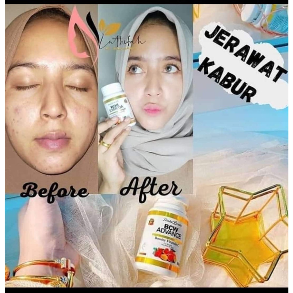 SUPPLEMENT PEMUTIH - BCW ADVANCE - BCW ADVANCE PEMUTIH BADAN AMAN