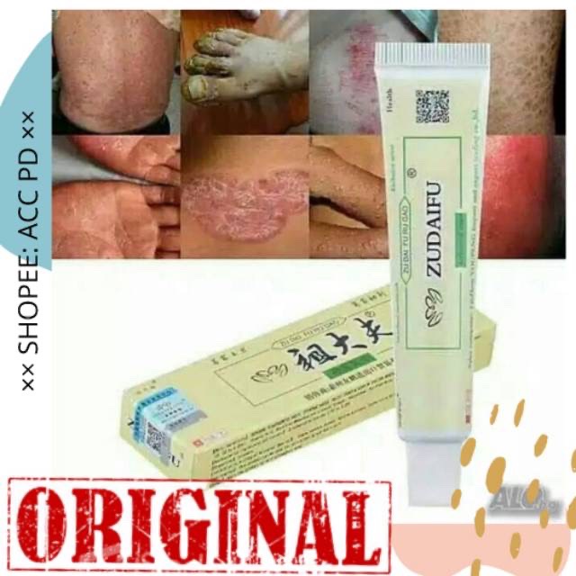 ZUDAIFU SALEP EKSIM OBAT CINA GATAL ORIGINAL SALEP PSOARISIS ROSACEA ANTI BAKTERI