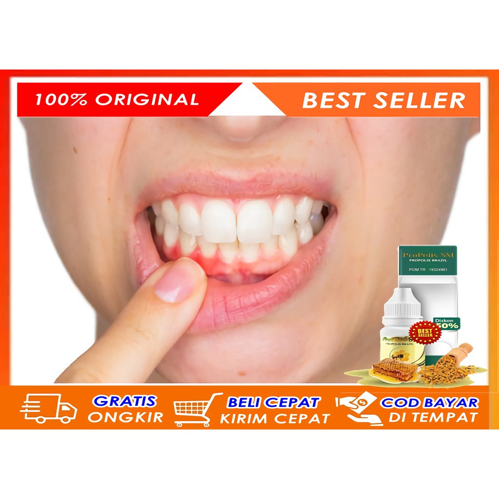 Propolis SM Ahlinya Atasi Masalah Gusi dan Gigi, Obat Tetes Sakit Gigi, Meredakan Sakit Gigi, Obat S