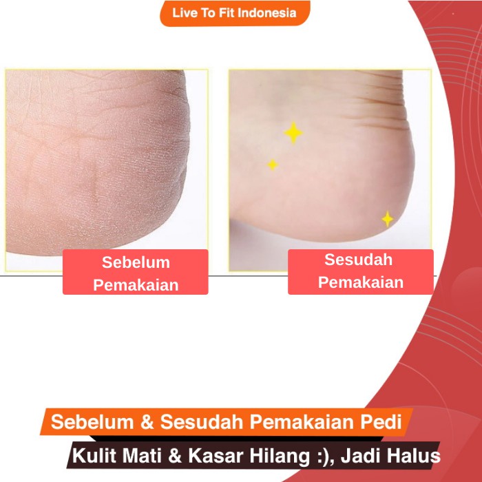 Alat Penghalus Perawatan Pembersih Kulit Tumit Kaki Kasar Personal Pedi Foot Care Spin GRATIS COD