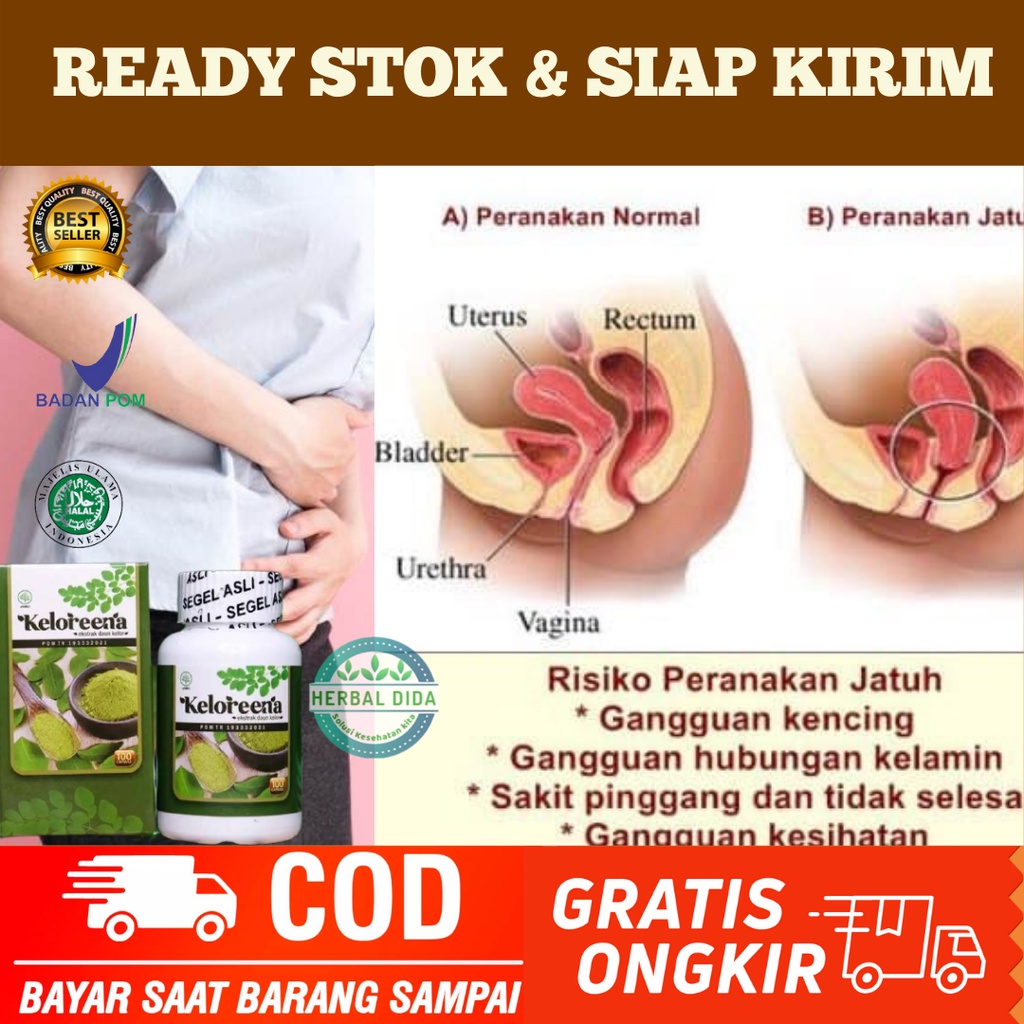 Obat Peranakan Turun / Jamu Turun Peranakan, OBAT HERBAL (RAHIM TURUN) ATAU PROLAPS UTERI, Obat herb