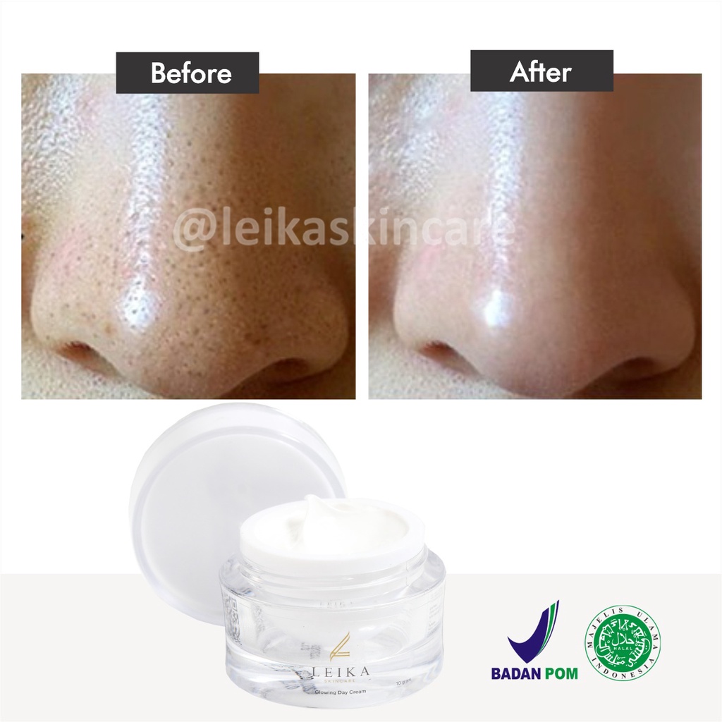 Krim Penghilang Komedo dan Jerawat di Hidung Cocok untuk Pria Wanita Krim penghilang komedo hitam membandel di hidung di wajah Glowing Day Cream Leika Skincare 10gr Korea Ampuh 100% Halal MUI Resmi BPOM