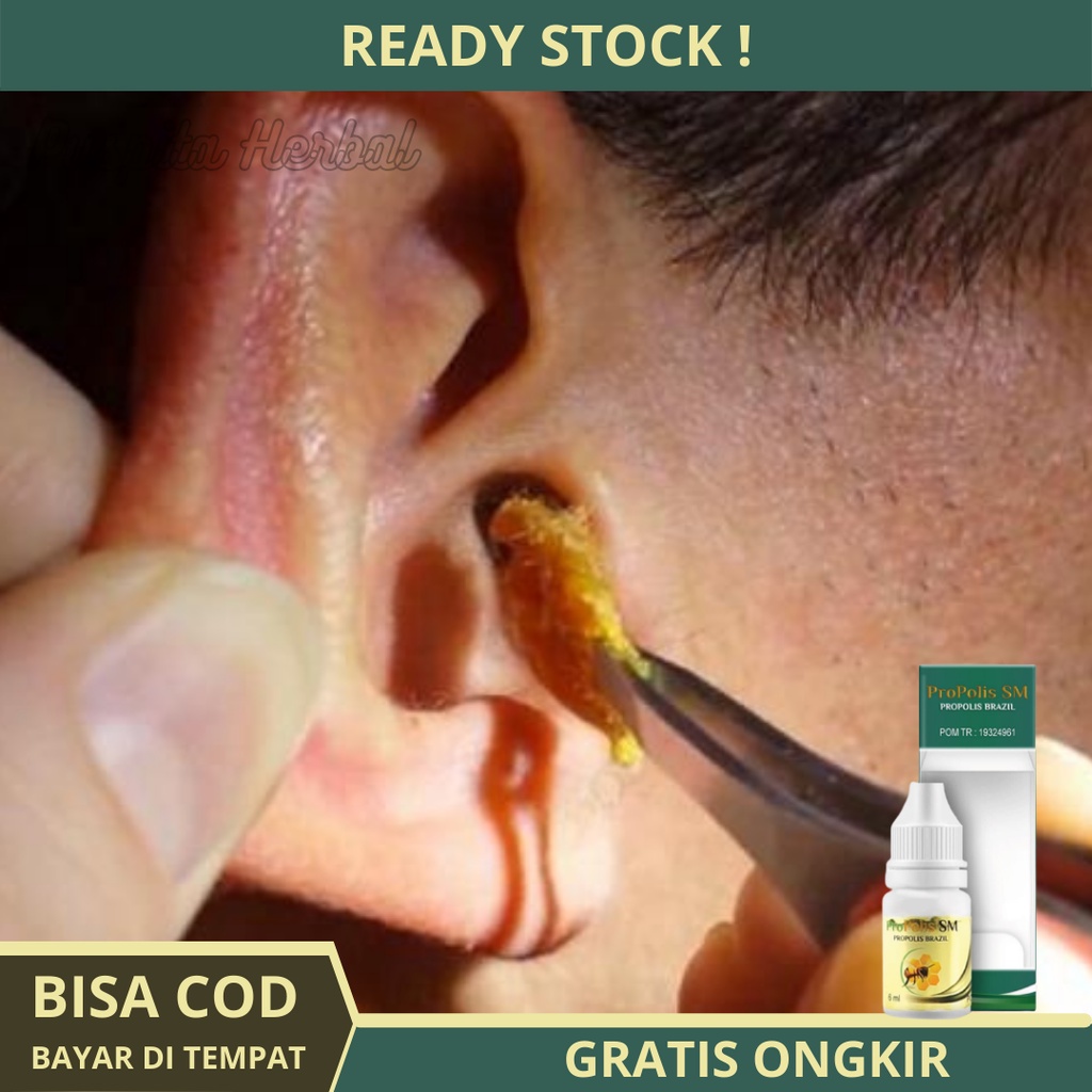 Obat Tetes Telinga Kotoran Keras - Melunakan Kototoran Telinga Keras - Mencairkan Kotoran Telinga Ke