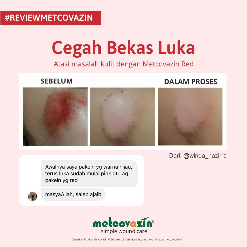 (Bisa COD) TERMURAH Metcovazin Red 25gr | Salep Segala Jenis Luka